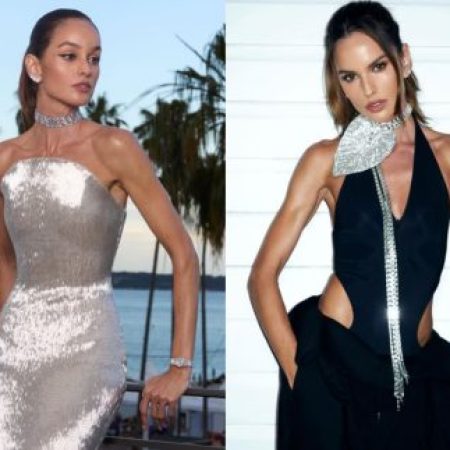 Izabel Goulart surge com rosto diferente após suposto procedimento e web reage