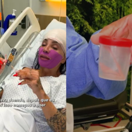 Maya Massafera faz cirurgia e retira parte do maxilar para deixar rosto “mais delicado”