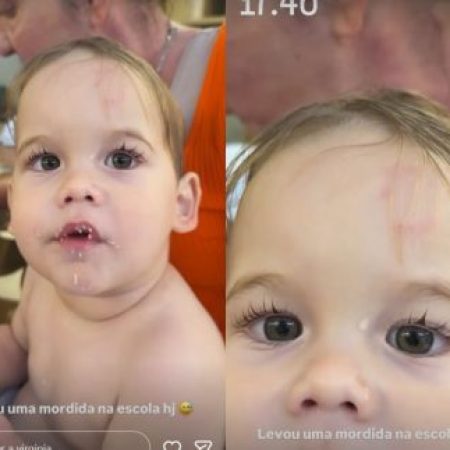 José Leonardo, filho de Virginia, é mordido na escola e influenciadora mostra hematoma